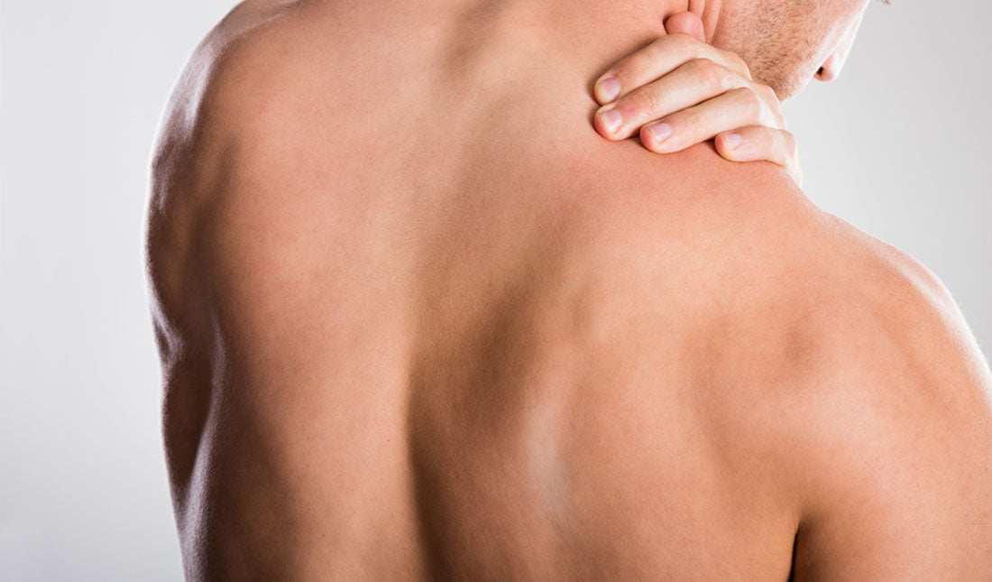 What Causes Back Acne in Males? 5 Likely Causes
