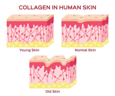 The Benefits of Soluble Collagen For Your Skin