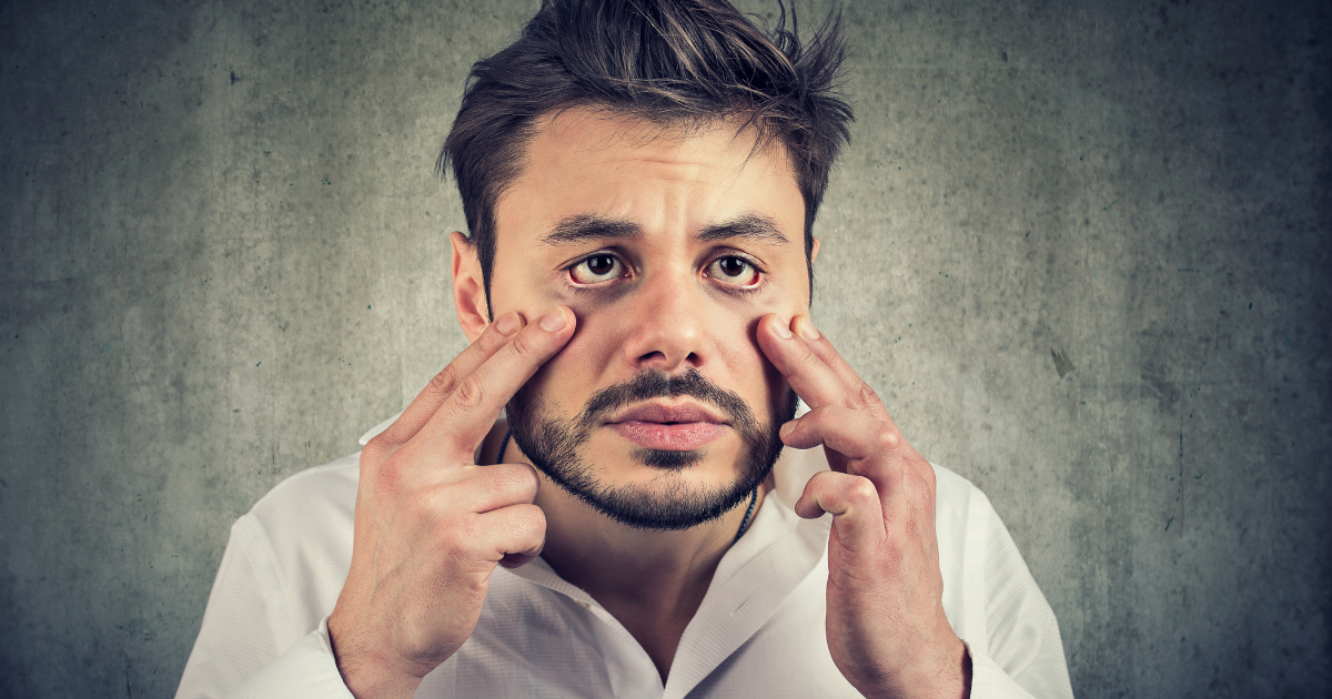 Under-Eye Bags and Crow's Feet: What They Are, Why They Happen, and How to Fix Them