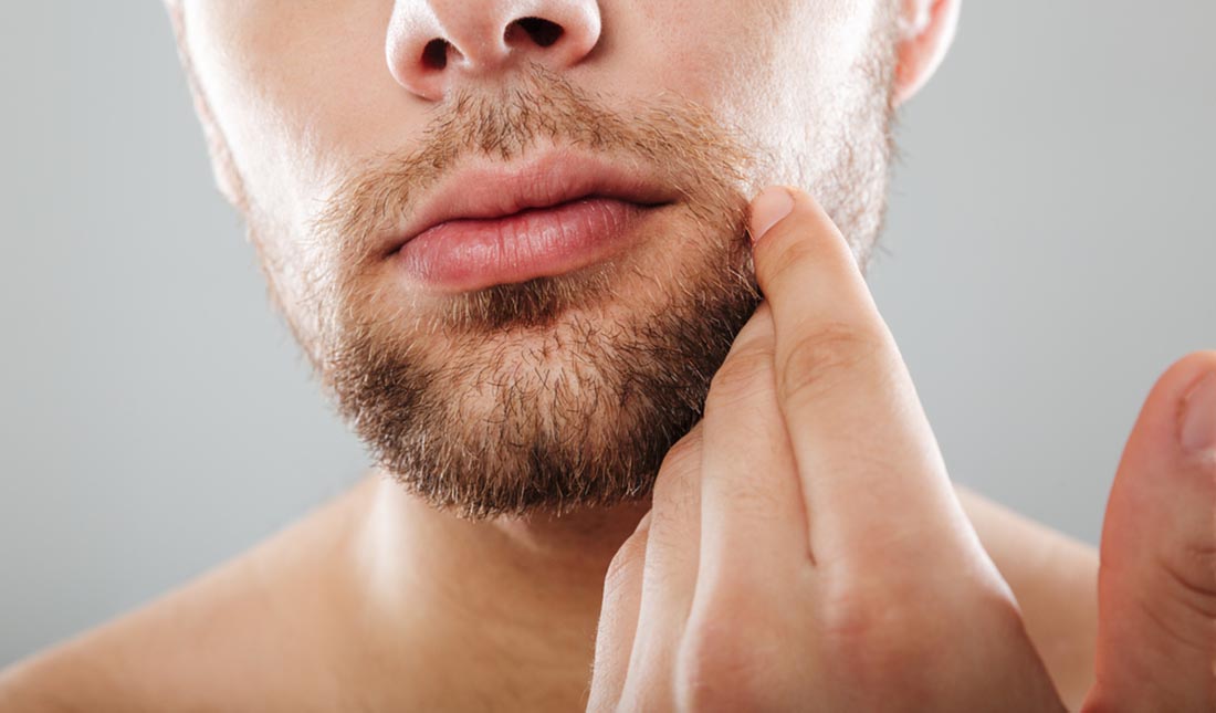 Beards Suffering Why Does My Beard Hurt? & Tiege Hanley