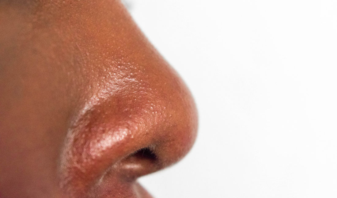 closeup oily skin on nose