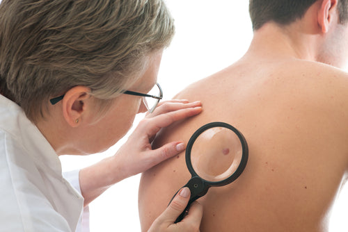 dermatologist examines mole