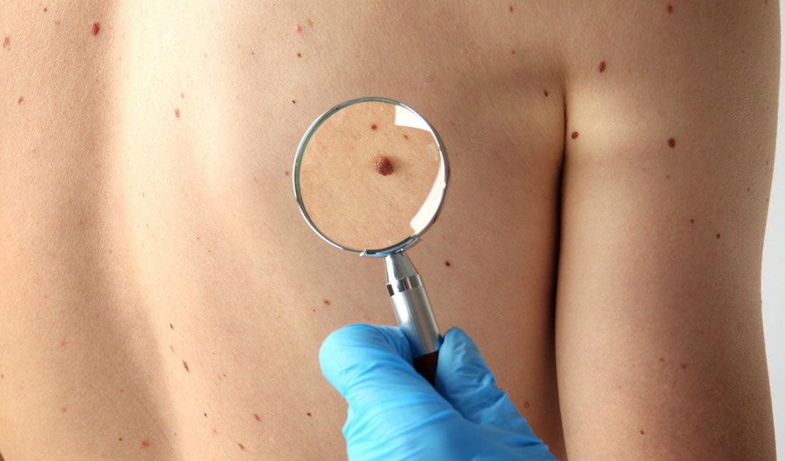 dermatologist examining back