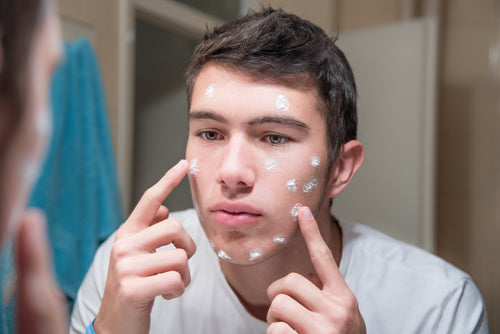 man applying acne creme