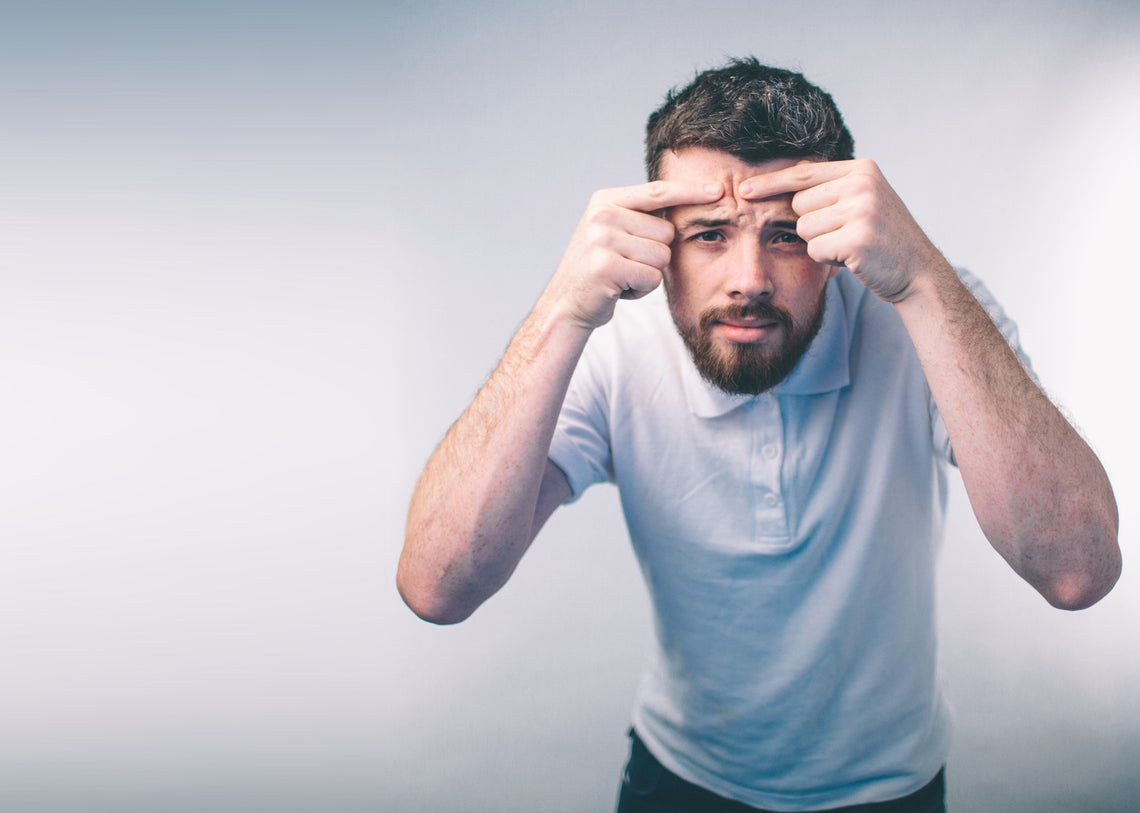 Man squeezing pimple on his forehead