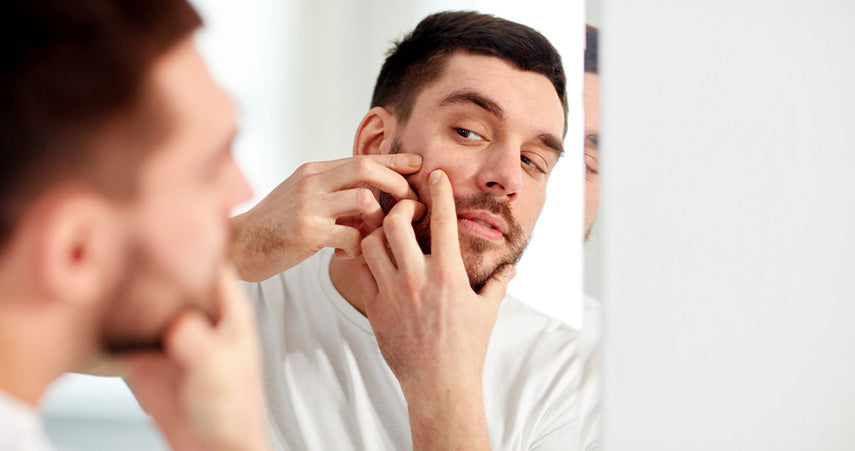 man squeezing blemish on face