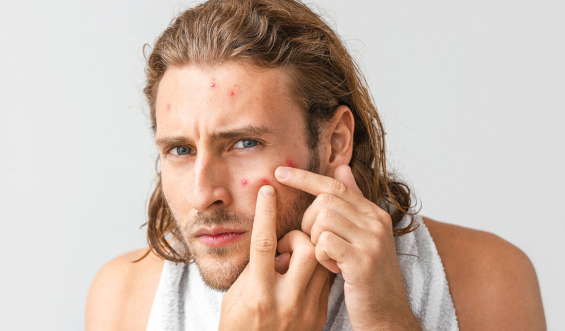 portrait of man popping pimple