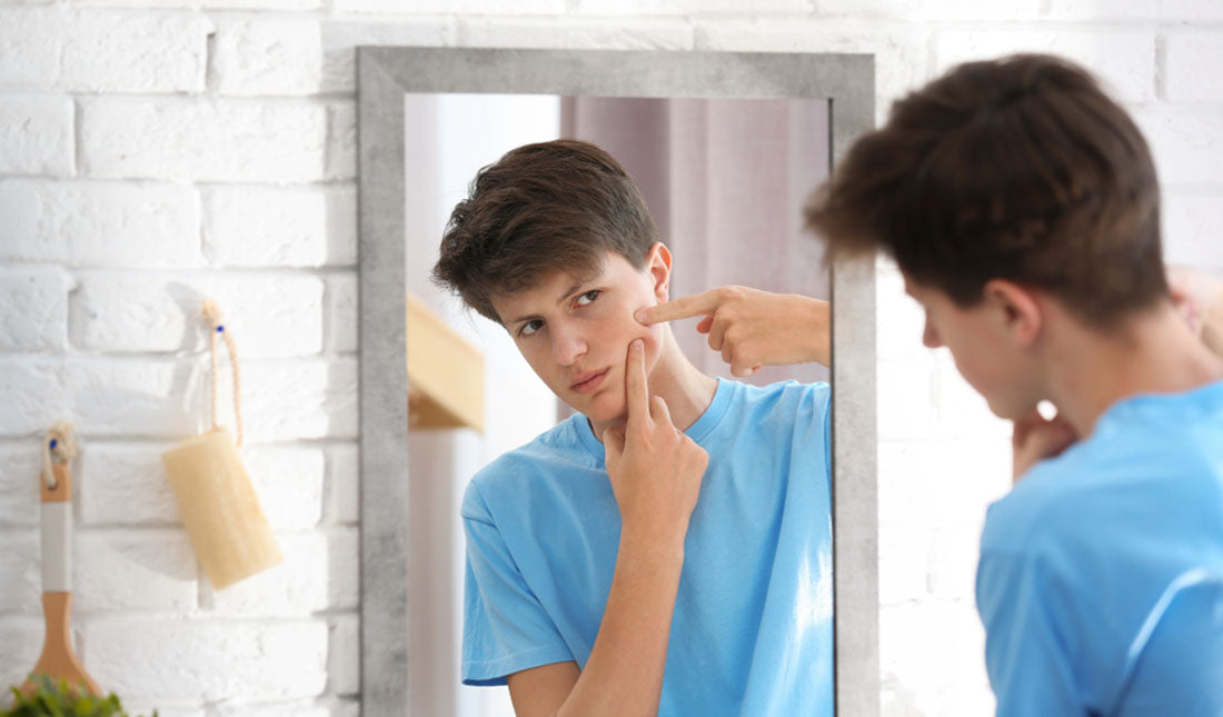 teenage boy acne problem