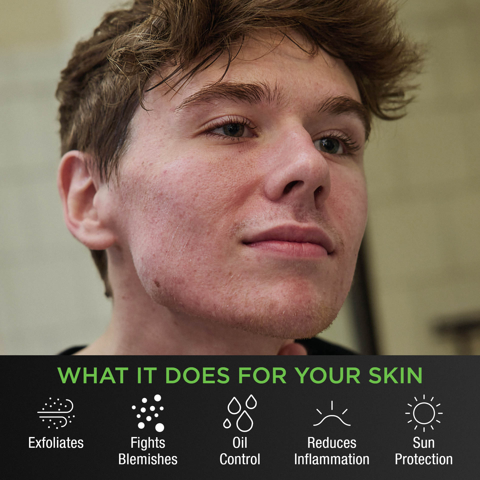 フェイスジェル・ゲル t Advanced Acne Treatment System for Men – Tiege Hanley